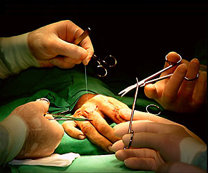 Belarus to conduct about 20 lung transplant surgeries yearly